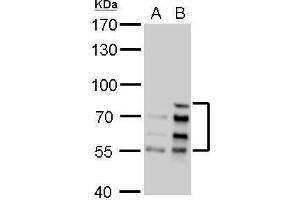 WB Image Lamin A + C antibody detects Lamin A + C protein by Western blot analysis. (Lamin A/C 抗体)