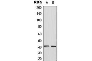 Western blot analysis of CCR4 expression in HL60 (A), MCF7 (B) whole cell lysates.