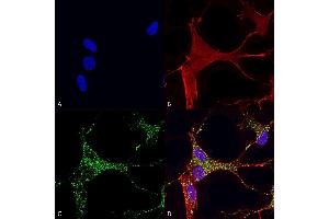 Immunocytochemistry/Immunofluorescence analysis using Mouse Anti-Cav3. (CACNA1G 抗体  (AA 2052-2172) (Atto 594))