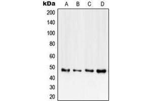 Western Blotting (WB) image for anti-Tumor Necrosis Factor Receptor Superfamily, Member 1B (TNFRSF1B) (C-Term) antibody (ABIN7297172)
