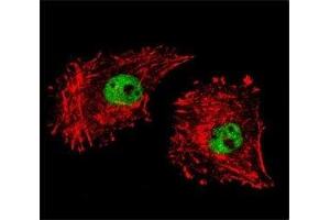 Confocal immunofluorescent analysis of FUS antibody with MDA-MB231 cells followed by Alexa Fluor 488-conjugated goat anti-rabbit lgG (green). (FUS 抗体  (AA 499-526))