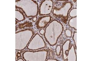 Immunohistochemical staining of human thyroid gland with UFSP2 polyclonal antibody  shows strong cytoplasmic and nuclear positivity in glandular cells at 1:500-1:1000 dilution. (UFSP2 抗体)