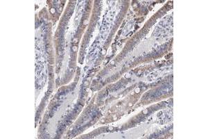 Immunohistochemical staining of human duodenum with PPRC1 polyclonal antibody  shows moderate cytoplasmic positivity in glandular cells at 1:500-1:1000 dilution. (PPRC1 抗体)