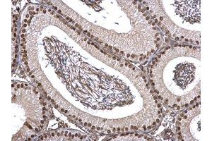 IHC-P Image FUBP1 antibody detects FUBP1 protein at nucleus on mouse testis by immunohistochemical analysis. (FUBP1 抗体)
