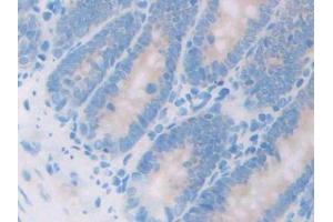 DAB staining on IHC-P; Samples: Rat Small intestine Tissue (HSD17B12 抗体  (AA 11-291))