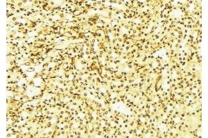 ABIN6276347 at 1/100 staining Mouse liver tissue by IHC-P. (SIRT2 抗体  (C-Term))