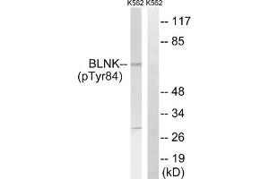 Western blot analysis of extracts from K562 cells, treated with starved (24hours), using BLNK (Phospho-Tyr84) antibody. (B-Cell Linker 抗体  (pTyr84))