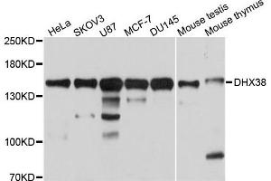 Western blot analysis of extracts of various cells, using DHX38 antibody. (DHX38 抗体)