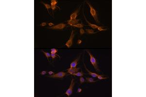 Immunofluorescence analysis of C6 cells using GST Rabbit pAb (8266) at dilution of 1:100 (40x lens). (GSTA1 抗体  (AA 1-222))