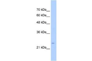 WB Suggested Anti-TMEM69 Antibody Titration:  0. (TMEM69 抗体  (Middle Region))