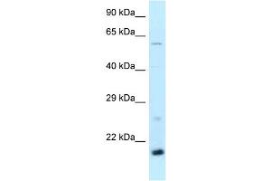 WB Suggested Anti-Dr1 Antibody Titration: 1. (DR1 抗体  (Middle Region))