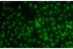 Immunofluorescence analysis of A549 cells using KLF3 Polyclonal Antibody (KLF3 抗体)