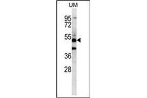 Western blot analysis of PNLIPRP3 Antibody (N-term) Cat. (PNLIPRP3 抗体  (N-Term))
