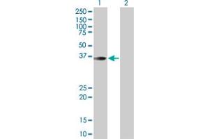 Lane 1: MEF2B transfected lysate ( 40. (MEF2B 293T Cell Transient Overexpression Lysate(Denatured))