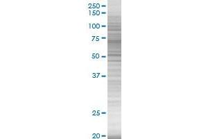 Western Blotting (WB) image for SERPING1 293T Cell Transient Overexpression Lysate(Denatured) (ABIN1331100)