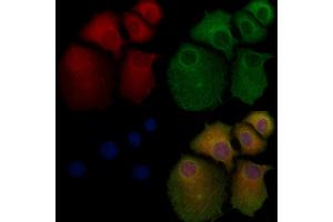 ABIN6261285 and ABIN6276758 staining Hela cells by IF/ICC. (Dihydrofolate Reductase 抗体  (N-Term))