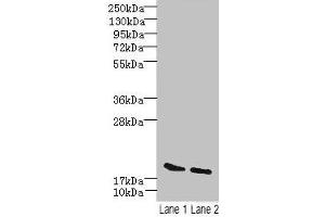 Western blot All lanes: SKP1 antibody at 15 μg/mL Lane 1: Mouse brain tissue Lane 2: Hela whole cell lysate Secondary Goat polyclonal to rabbit IgG at 1/10000 dilution Predicted band size: 19 kDa Observed band size: 19 kDa (SKP1 抗体  (AA 2-163))
