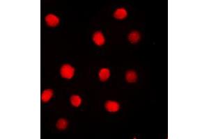 Immunofluorescent analysis of Separase (pS801) staining in MDAMB231 cells. (Separase 抗体  (pSer801))