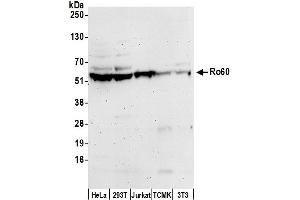Western Blotting (WB) image for anti-TROVE Domain Family, Member 2 (TROVE2) (AA 488-538) antibody (ABIN7450670)