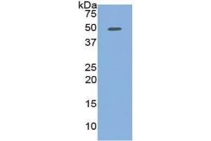 WB of Protein Standard: different control antibodies against Highly purified E. (PCOLCE ELISA 试剂盒)