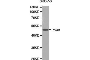 Western Blotting (WB) image for anti-Paired Box 8 (PAX8) (AA 1-212) antibody (ABIN1681270)