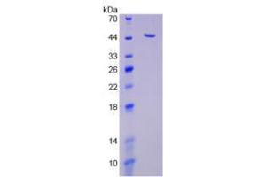 Image no. 1 for Sialidase 1 (Lysosomal Sialidase) (NEU1) (AA 47-415) (Active) protein (His tag) (ABIN6239836) (NEU1 Protein (AA 47-415) (His tag))