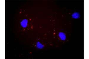Proximity Ligation Analysis of protein-protein interactions between PTK2 and ITGAV. (CD51 抗体  (AA 1-1048))