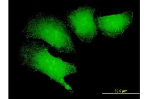 Immunofluorescence of purified MaxPab antibody to MAGEB18 on HeLa cell. (MAGEB18 抗体  (AA 1-343))