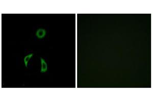 Immunofluorescence analysis of A549 cells, using FZD3 antibody. (FZD3 抗体  (Internal Region))