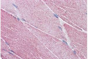 Human Skeletal Muscle: Formalin-Fixed, Paraffin-Embedded (FFPE) (PCSK6 抗体  (AA 637-648))