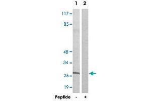 Western blot analysis of extracts from NIH/3T3 cells, using KDELR3 polyclonal antibody . (KDELR3 抗体)