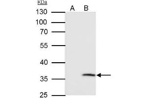 Immunoprecipitation (IP) image for anti-Voltage-Dependent Anion Channel 2 (VDAC2) (C-Term) antibody (ABIN2855930)