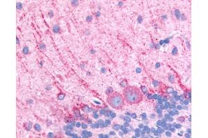 Anti-DRD5 / Dopamine Receptor D5 antibody IHC of rat brain, Purkinje neurons. (DRD5 抗体  (Extracellular Domain))