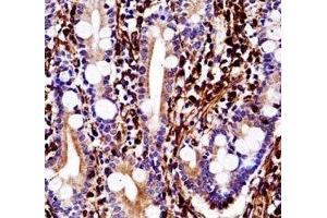 Vimentin antibody immunohistochemistry analysis in formalin fixed and paraffin embedded human small intestine tissue