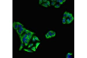 Immunofluorescent analysis of PC-3 cells using ABIN7157524 at dilution of 1:100 and Alexa Fluor 488-congugated AffiniPure Goat Anti-Rabbit IgG(H+L) (KIR3DL1 抗体  (AA 81-336))