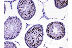 IHC analysis of MED8 using anti-MED8 antibody . (MED8 抗体  (AA 1-195))
