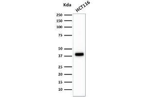 Western Blotting (WB) image for anti-Keratin 18 (KRT18) antibody (ABIN6939935)