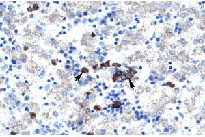 Human kidney (Activator of Basal Transcription 1 抗体  (Middle Region))