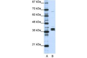 WB Suggested Anti-HNRPDL  Antibody Titration: 1.