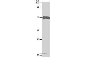 Western blot analysis of Hela cell, using BAG5 Polyclonal Antibody at dilution of 1:500 (BAG5 抗体)
