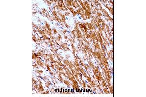 Mouse Pdk2 Antibody (N-term) ((ABIN657996 and ABIN2846942))immunohistochemistry analysis in formalin fixed and paraffin embedded mouse heart tissue followed by peroxidase conjugation of the secondary antibody and DAB staining. (PDK2 抗体  (N-Term))