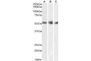 ABIN185674 (1µg/ml) staining of Human Spleen (A), Kidney (B) and Testis (C) lysates (35µg protein in RIPA buffer). (WT1 抗体  (N-Term))