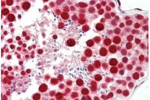 Human Testis: Formalin-Fixed, Paraffin-Embedded (FFPE) (TARDBP 抗体  (AA 1-30))