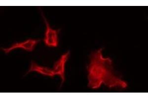 ABIN6275352 staining A549 by IF/ICC. (PEX2 抗体  (Internal Region))