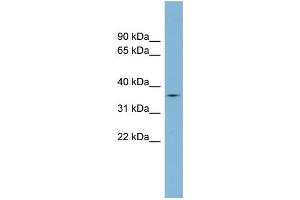 WB Suggested Anti-TMPRSS12 Antibody Titration: 0. (TMPRSS12 抗体  (Middle Region))
