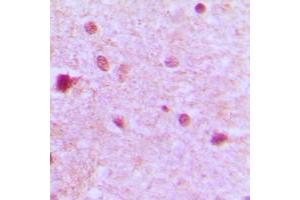 Immunohistochemical analysis of ZFP36L1 staining in human brain formalin fixed paraffin embedded tissue section. (ZFP36L1 抗体  (Center))