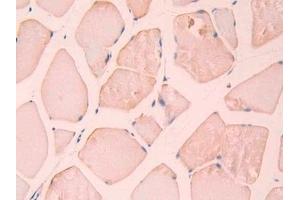 Detection of CA12 in Rat Skeletal muscle Tissue using Polyclonal Antibody to Carbonic Anhydrase XII (CA12) (CA12 抗体  (AA 154-307))