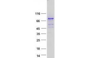 Western Blotting (WB) image for Protein Phosphatase, Mg2+/Mn2+ Dependent, 1D (PPM1D) protein (Myc-DYKDDDDK Tag) (ABIN2729806)