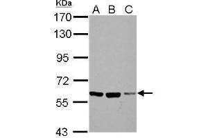 WB Image Sample (30 ug of whole cell lysate) A: NIH-3T3 B: JC C: BCL-1 7. (FZD10 抗体  (N-Term))