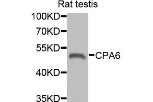 Western blot analysis of extracts of rat testis, using CPA6 antibody. (CPA6 抗体)
